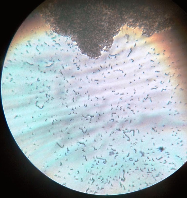 bacterias al microscopio
